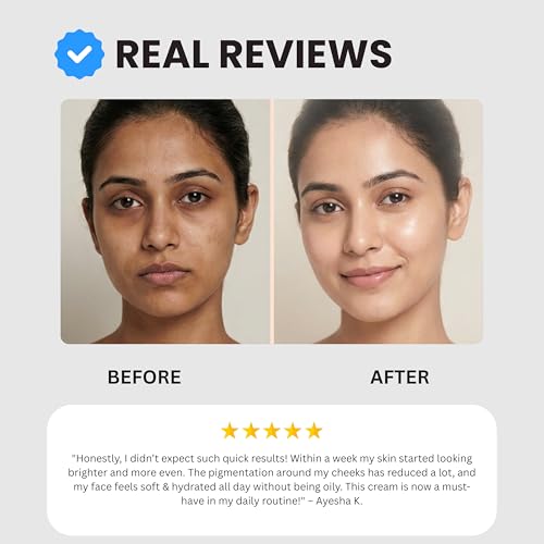 Image of Wise & Secrets B+ Face Brightening Cream 25gm (Pack of 4) for Dark Spots & Pigmentation | Kojic Acid, Niacinamide & Alpha Arbutin | Melasma & Acne Marks Remover Skin Tone Corrector & Glow Cream Unisex
