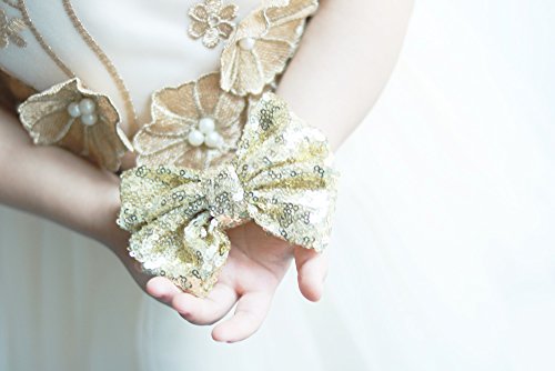 Missgrace Hot Gold Hair Bow.hair Bows, Hair Clips,Girls Hair Bows.hair Bows #TOP4