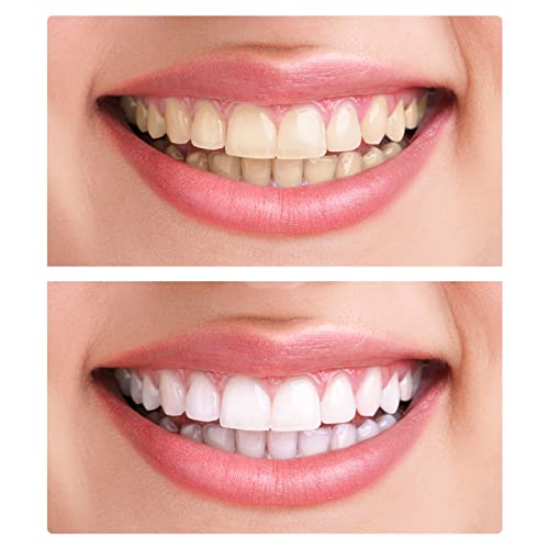 Cnll Dentes falsos, dentes de dentadura de 2 peças para maxilar superior e inferior, natureza e conf