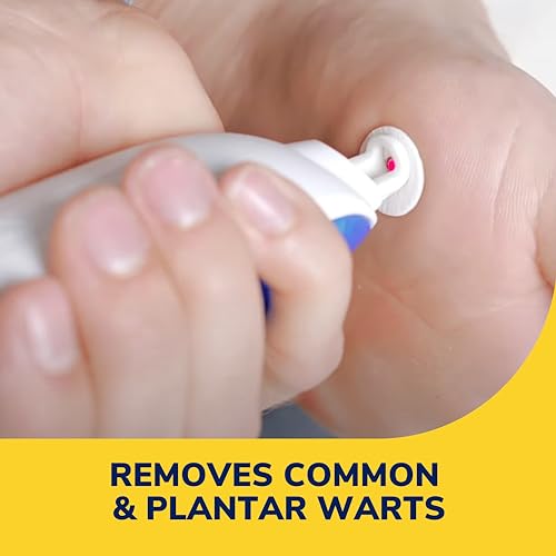 dr scholl39s freeze away max wart remover 10 treatments - as fast as 10 seconds to treat warts removes common warts amp plantar warts on hands amp feet easy to use precision spray for wart removal