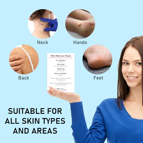Image of WABRINY Wart Remover Patches, Fast & Easy Operate Hydrocolloid Gel Waterproof Invisible Sticker -CM