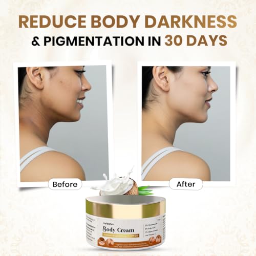 Image of myUpchar 2% Kojic Acid, 1% Alpha Arbutin with Vitamin C & 5% Niacinamide | Brightening & Skin Tone Correcting Body Cream | Dark Spot Removal for Elbows, Neck, Underarms, Knees | 55gm