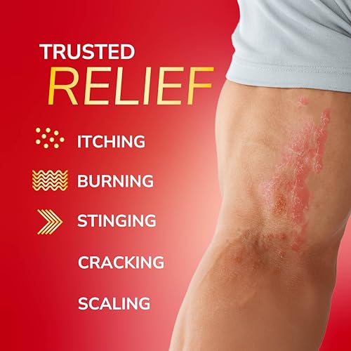 Dr. Scholl\'s Fungal-X Cream - Treatment for Athlete\'s Foot, Jock Itch, Ringworm, Relief from Itching, Burning, Stinging, Treat & Beat in 7 Days, Full Prescription Strength, 1 oz