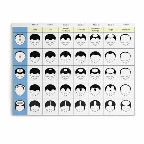 AYTGBF Hair Loss Classification Poster 26x20in Wall Art