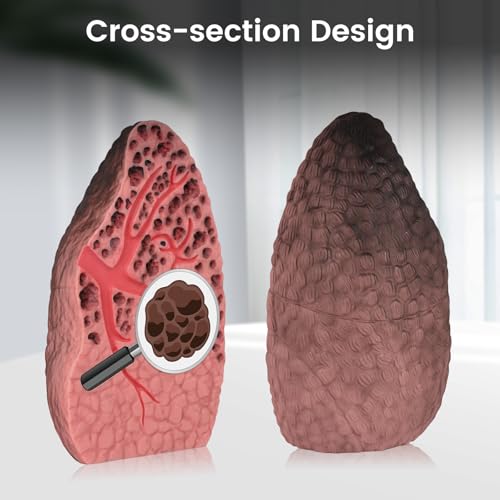 Image of Ultrassist Smoking Lung Model with Tar Damage, Lung Anatomy Model for Smoking Education