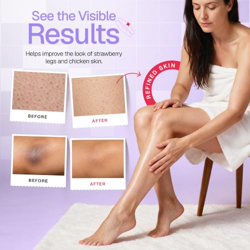 Image of DERMAdoctor KP Bump Eraser Vanilla Body Scrub, Keratosis Pilaris, 2oz