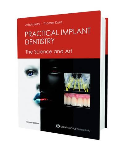 Practical Implant Dentistry