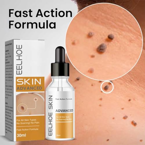 Image of Skin Tag & Mole Remover Serum - Quick-Acting Natural Formula for Face and Body - Simple to Use, 30ML