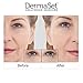DermaSet Anti-Aging 3D Renewal Cream - Clinically Tested and Hypoallergenic Formula