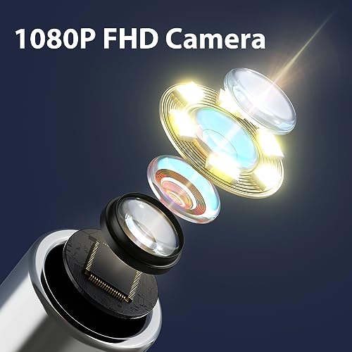 Image of Ear Wax Removal Tool Camera, 1080P Ear Cleaner with Anti-Dust Cover, Wifi Ear Camera Otoscope with Ear Pick Set for iPhone, iPad & Android Smart Phones