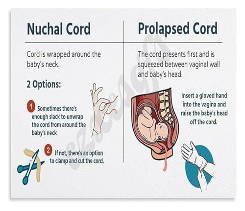 Field Delivery Guide Poster Managing Obstetric Emergencies Prehospital Reference for Emergency Medicine Canvas(Unframed,12x18inc