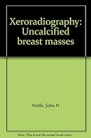 Xeroradiography: Uncalcified breast masses 0398035040 Book Cover