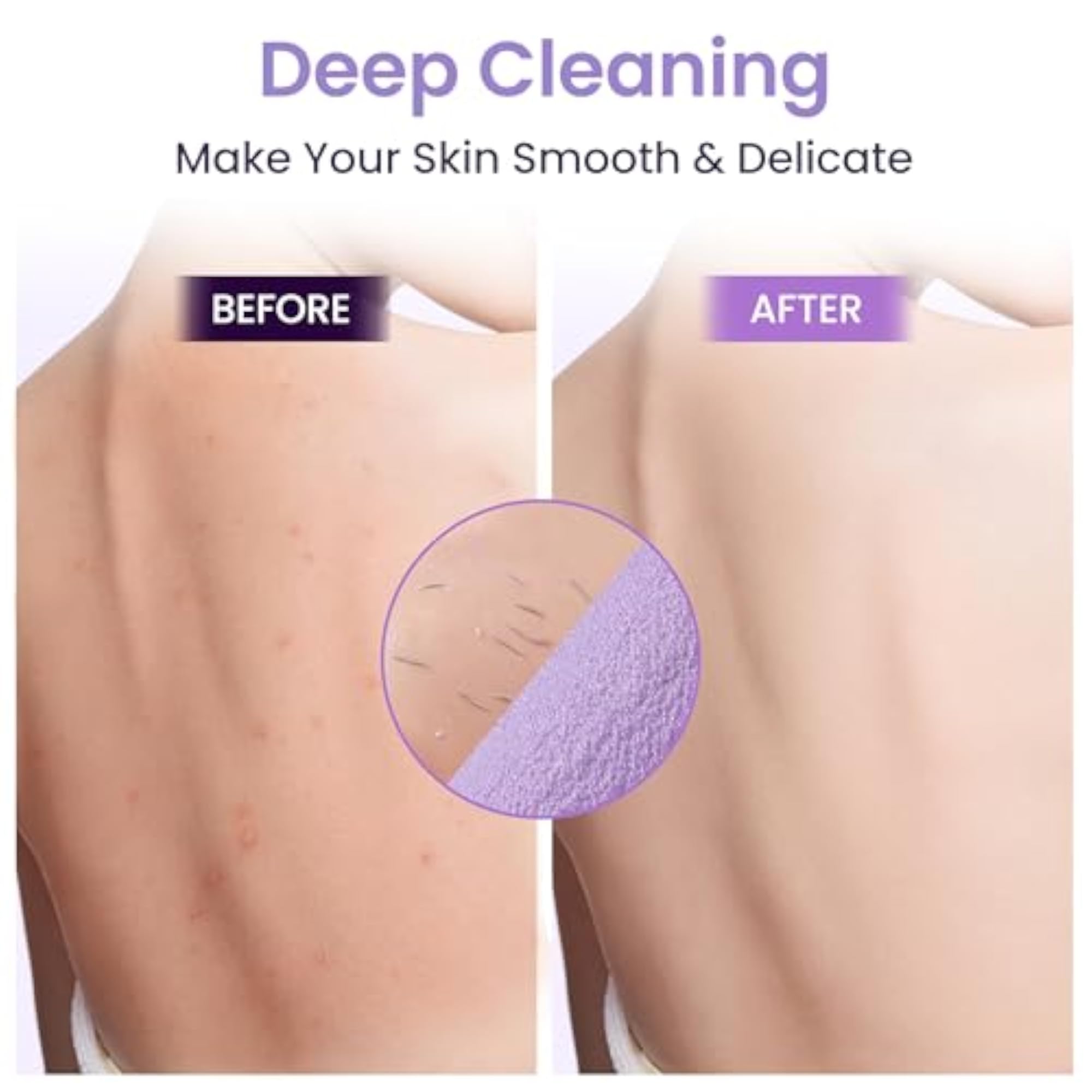 3 Pcs Double-Sided Back Exfoliator Body Scrub Towel