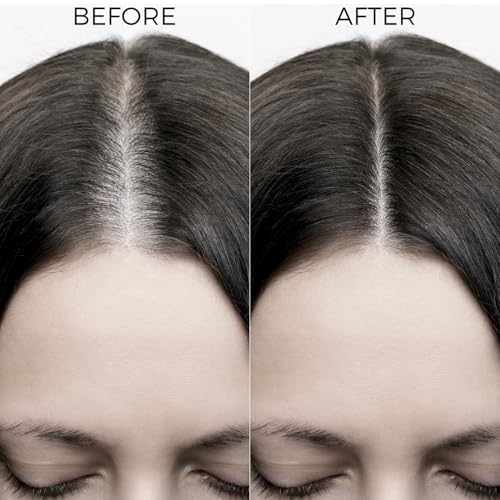Image of Brillare 10% Rosemary Hair Oil for Hair Growth with 10% Olive Oil & 5% Castor oil | Reduces Hair Fall | Strengthens Hair | Visible Results in 4 Weeks. (Pack of 2)