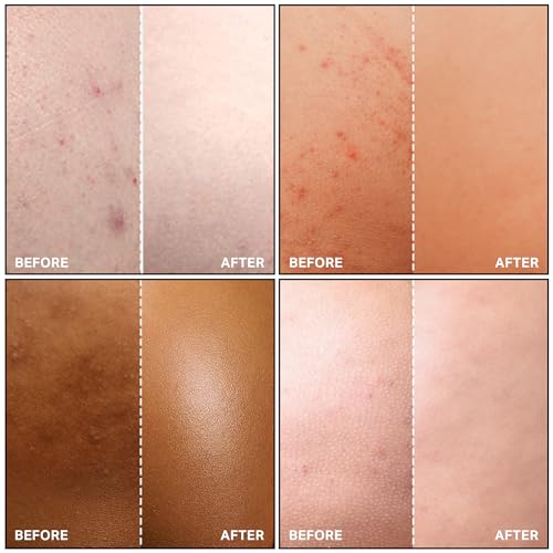 Green Heart Labs Clearing Lotion for Body, Back, Bum, & Thigh