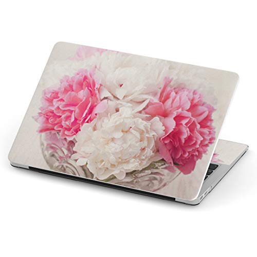 igsticker MacBook Air 13inch 2018 2019 2020 ���f�� / A1932 ��p�X�L���V�[�� �}�b�N�u�b�N �G�A Mac 13" �C���` Retina ��p�V�[�� �t�B���� �X�e�b�J�[ �A�N�Z�T���[ �ی� (2010�N 