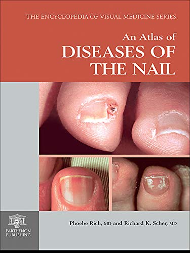 An Atlas of Diseases of the Nail (Encyclopedia of Visual Medicine Series)
