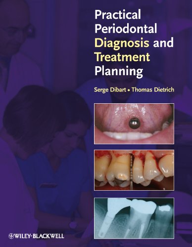 Practical Periodontal Diagnosis and Treatment Planning (English Edition)