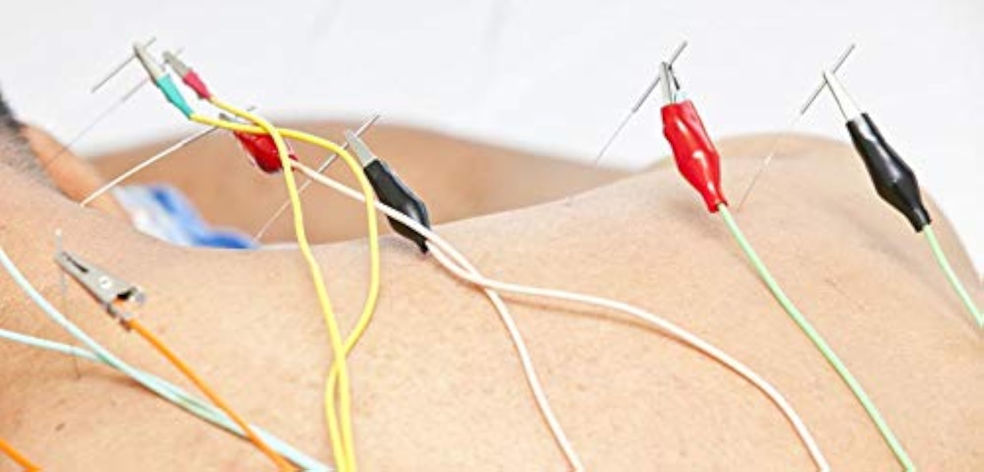 R A Products Electro Acupuncture Stimulator Therapy Machine