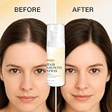 Hair Growth Spray, With Rosemary Oil and Biotin, Non-Greasy, Helps Prevent Hair Thinning & Hair Loss, for Scalp, Non-Sticky, Non-Crunchy, H/air Volumizer S/pray, Humidity-Resistant Volumizing S/pray - Image 6