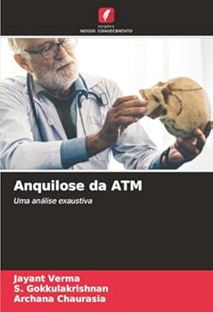 Paperback Anquilose da ATM [Portuguese] Book