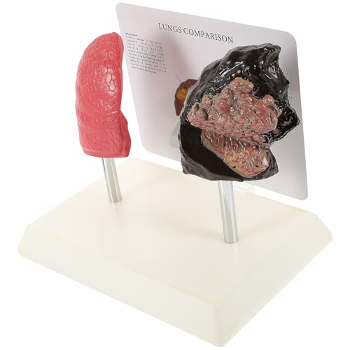 Modelo de pulmón patológico DOITOOL en PVC para clases de anatomía