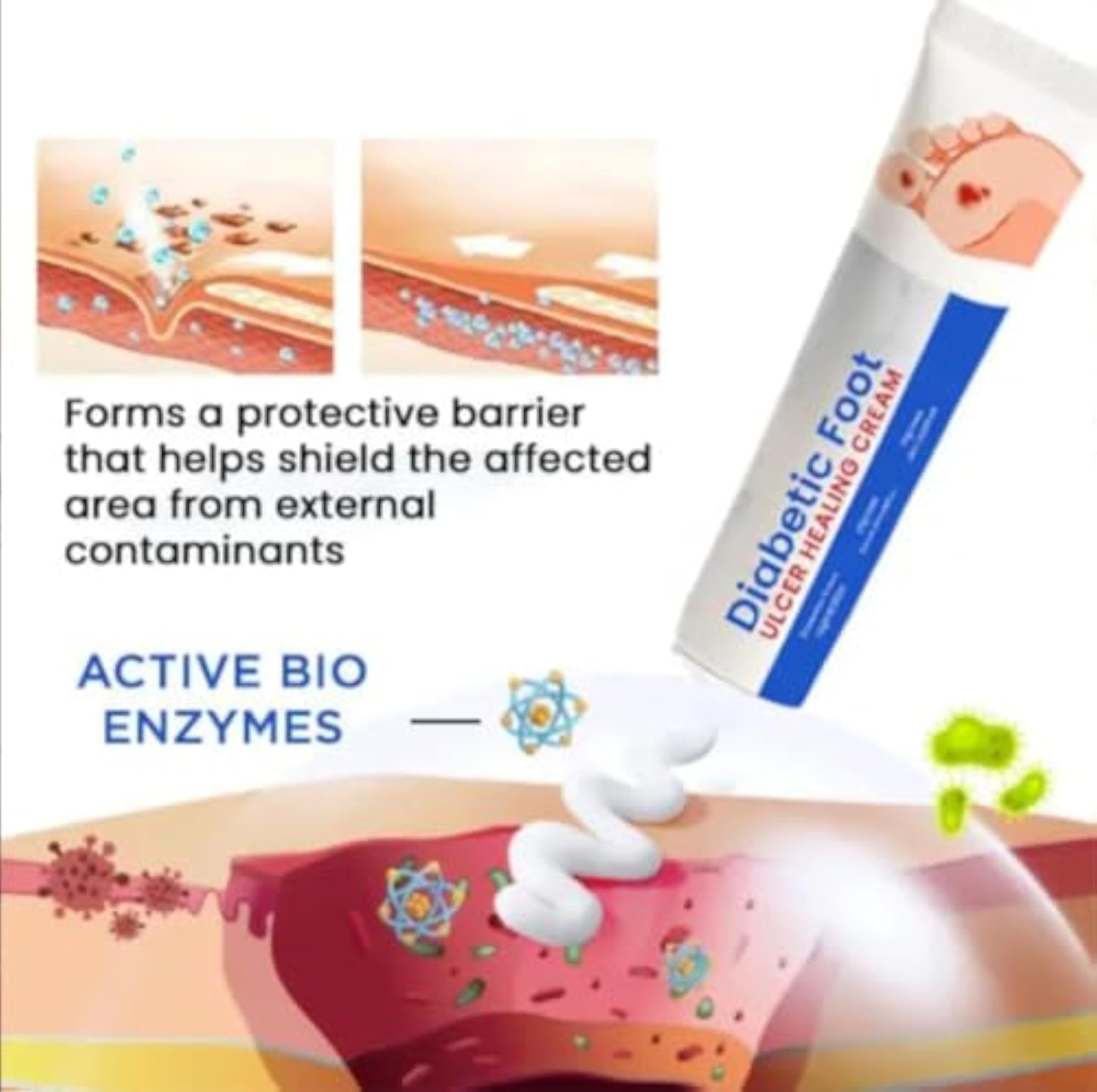 Diabetic Foot Ulcer Healing Cream, Advanced Wound Care Formula