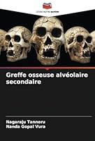 Greffe osseuse alvéolaire secondaire (French Edition) 6208724759 Book Cover