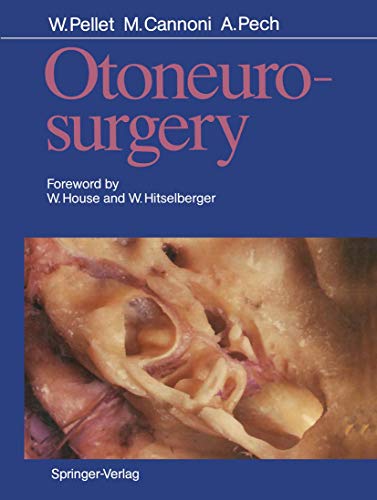 Otoneurosurgery view 2