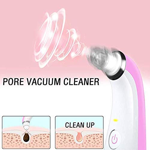 Vacuum Blackhead Remover, QQcute Electric Pore Cleaner Blackhead Extractor Tool Instrument Comedo Suction Removal Beauty Device for Facial Skin Care