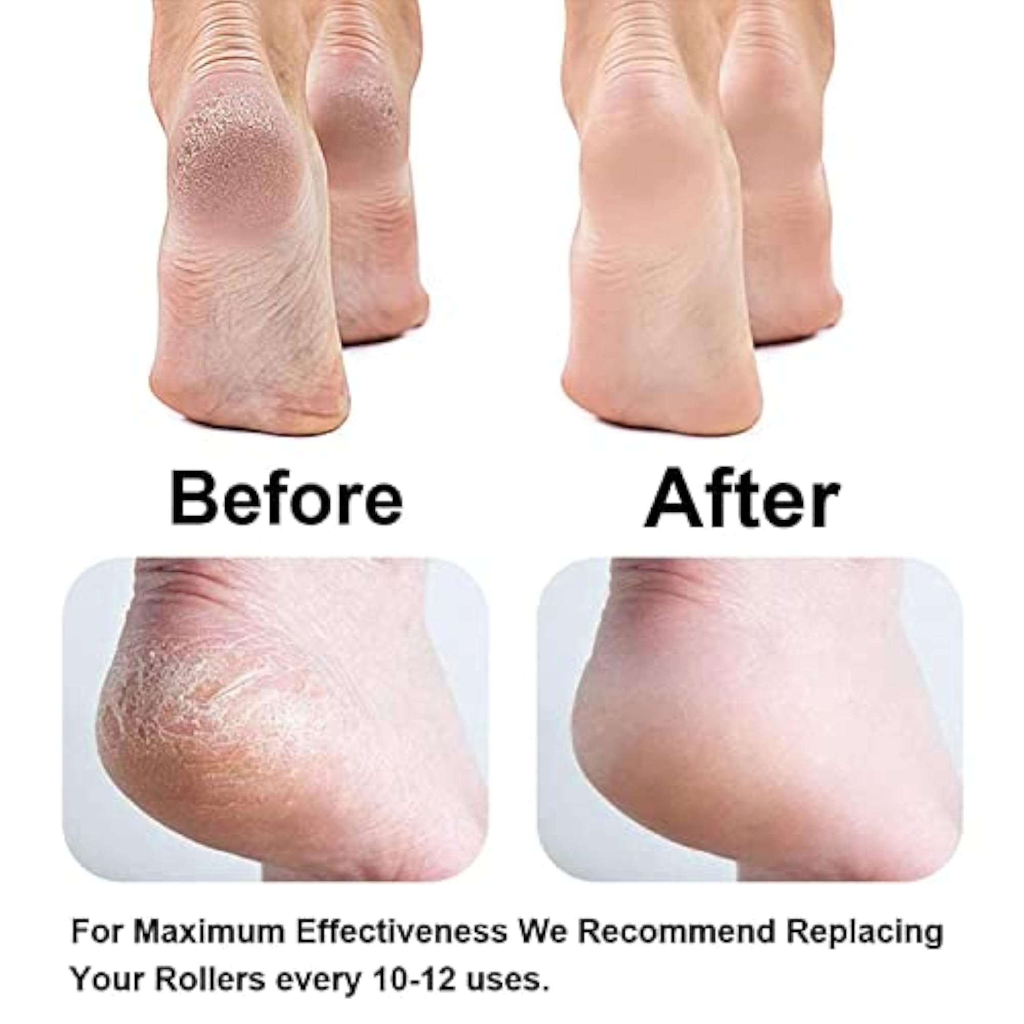 Rechargeable Pedicure Tool - Dead Skin Remover