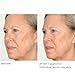 Nassif MD Hydro-Screen Serum