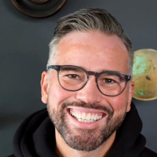 EP343- Dean Edwards: I Am Proud Of My Vitiligo