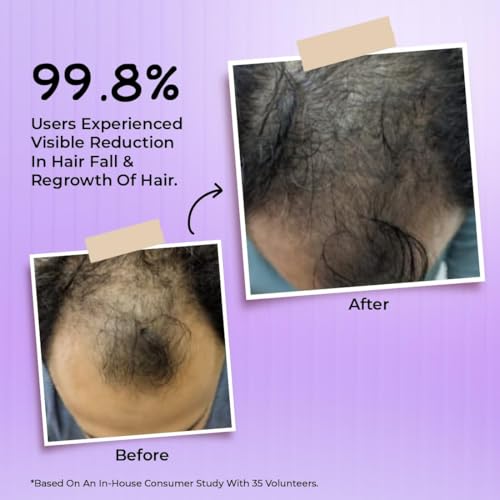 Image of Dr. Bakshi's BAKSON'S HOMOEOPATHY Hair Reviver-100 Ml
