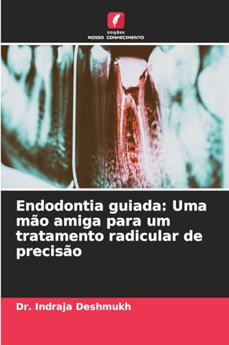 Endodontia guiada: Uma mão amiga para um tratamento radicular de precisão (Portuguese Edition)