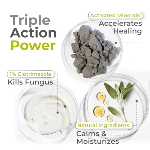 terrasil clotrimazole antifungal cream relief for fungal yeast infections jock itch athletes foot ringworm for men amp women clinically proven treatment of skin fungus fsa - hsa eligible 05oz