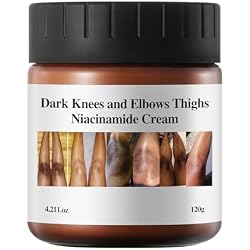 YAFUSIPE Dark Knuckle Remover Underarm Cream Body Moisturizer Lotion Dark Toe Knuckle Treatment Removal Corrector for Armpit Knees Elbow Inner Thigh Neck Private Part Intimate Skin Cream 4.21floz/120g