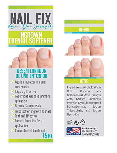 Nails ~ DESENTERRADOR UÑAS ENTERRADA by Ingrown Toenail