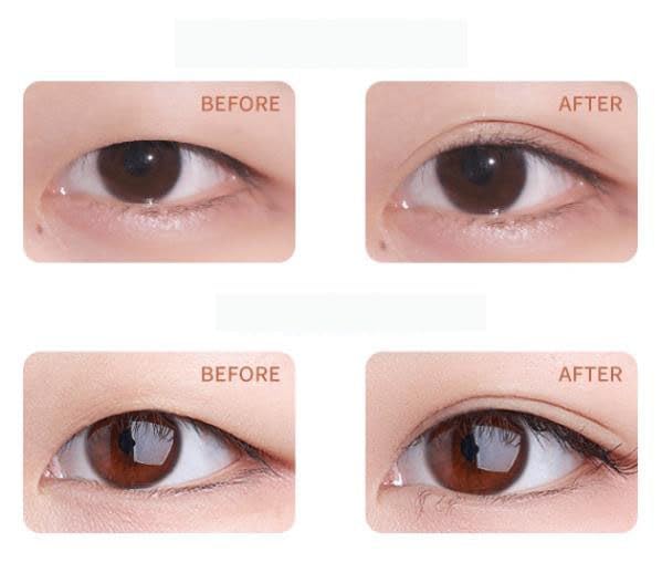 Miniatura 5 de Cinta para párpados Generalizy, Satvee, cintas impermeables de doble párpado, tiras invisibles para levantamiento de ojos, tiras de elevación de