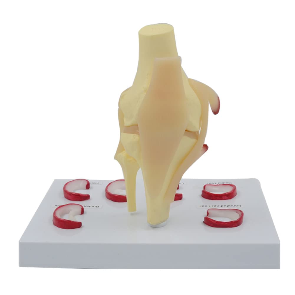 Modelo de sutura de menisco modelo anatómico de instrumentos de enseñanza médica de menisco humano de tamaño real