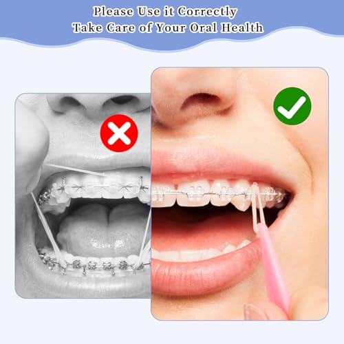 500 Stück Zahnspange Gummi, Kieferorthopädische Elastische, Orthodontic Latex Elastics, Mit 5 Stück Platzierer, Geeignet für Zahnspangen, Zahnlücken und Schiefe Zähne (Fuchs 1/4\)