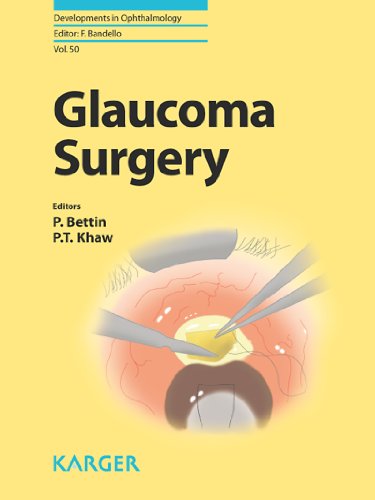 Glaucoma Surgery (Developments in Ophthalmology Book 50)