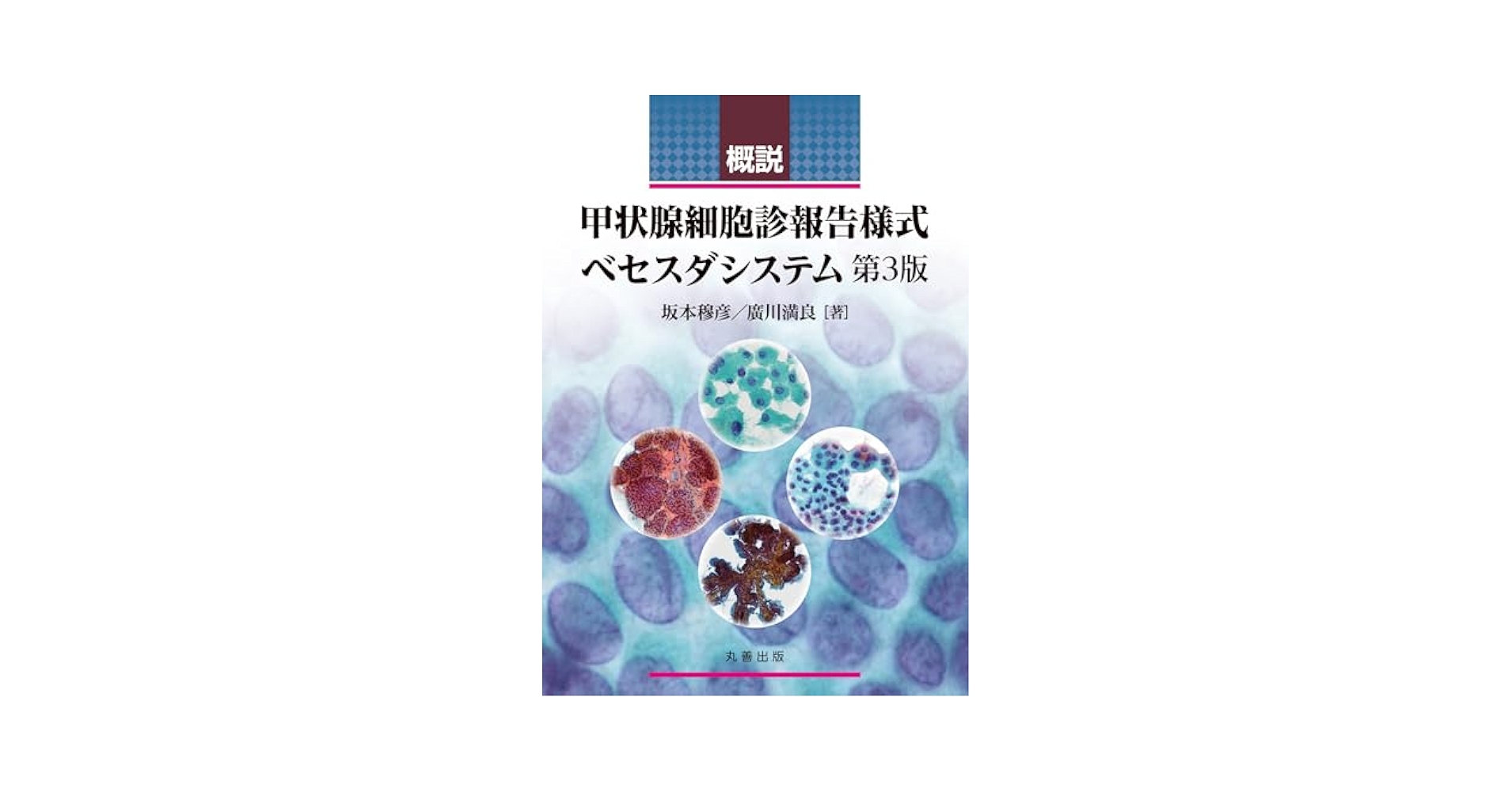 甲状腺癌 (腫瘍病理鑑別診断アトラス) 坂本穆彦; 廣川満良 甲状腺癌 (腫瘍病理鑑別診断アトラス) | 坂本穆彦, 廣川満良 |本