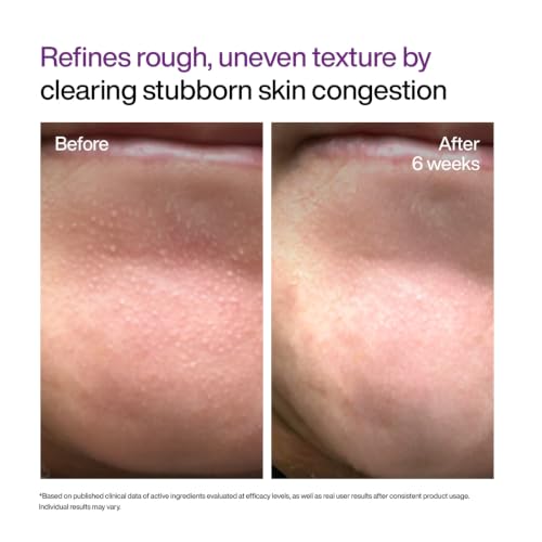 WishCare Cellular Reset 0.1% Retinal Shot- Targets Fine Lines, Wrinkles & Dark Circles | Retinol Shot Booster- 10 ml - Image 6