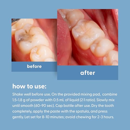 Dental Tooth Repair Kit, Easy & Portable Temporary Filling Cement with Strong Adhesive for Chipped, Missing & Broken Teeth, Solution for Loose Crowns & Cavities, Travel Case Included, by M3 Naturals
