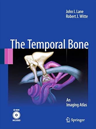 Temporal Bone: An Imaging Atlas 2010th Edition book cover