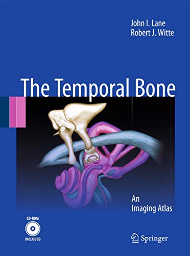 Temporal Bone: An Imaging Atlas view 2
