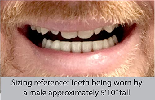 Instant Smile 12208 Professional Cosmetic Lower Teeth thumb #5