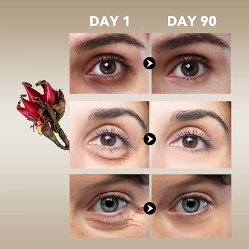 Under-Eye-Cream-with-Frankincense-Resin-ChamomileWrinkle-Cream-for-Women-Eye-Serum-for-Dark-Circles-and-Puffiness-Eye-Bags-All-Natural-Sensitive-Muscle-Friendly