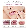 Lip-Masks-Collagen-Lip-Mask-20-Pcs-Lip-Mask-for-Dry-Lips-Lip-Masks-Skincare-Crystal-Lip-Pads-for-Moisturizing-Anti-Wrinkle-Anti-Aging-Firms-Hydrates-Lips-Red VEZE Lip Masks, Collagen Lip Mask 20 Pcs, Lip Mask for Dry Lips, Lip Masks Skincare, Crystal Lip Pads for Moisturizing, Anti-Wrinkle, Anti-Aging, Firms and Hydrates Lips Red